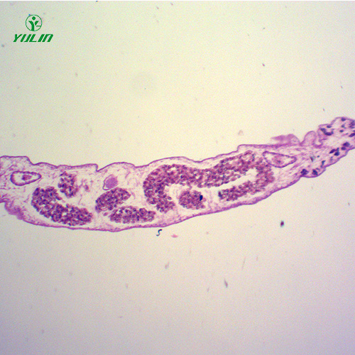 医学蠕虫吸虫生物切片